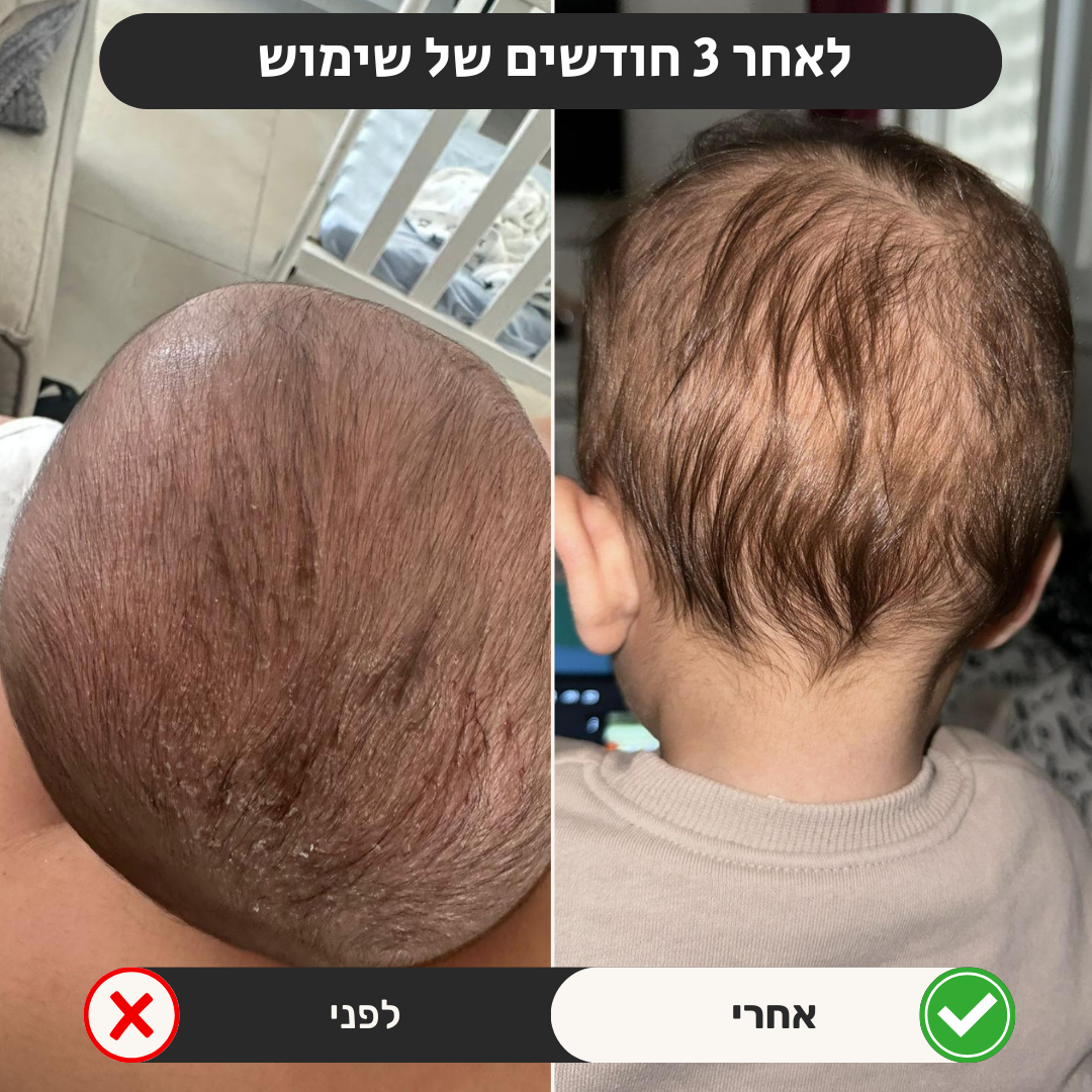 כרית תינוקות | למניעת ראש שטוח