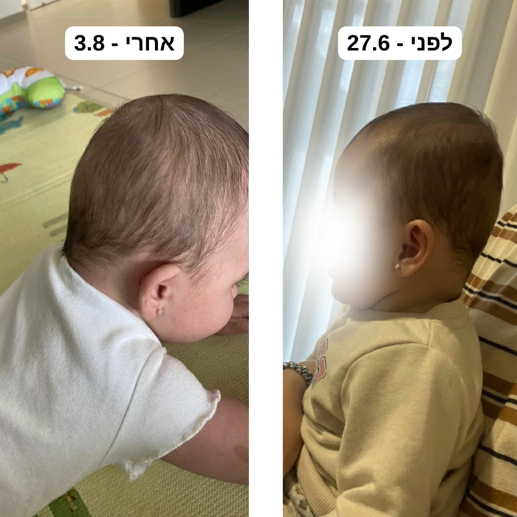 כרית תינוקות | למניעת ראש שטוח